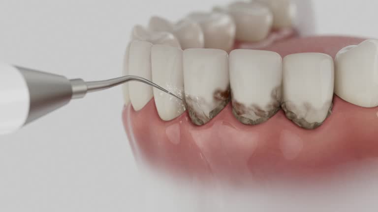 Reliable Dental Implants contractor in Flagstaff, AZ by Smile Center Dentistry
